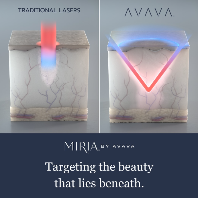 AVAVA Laser (Face)
