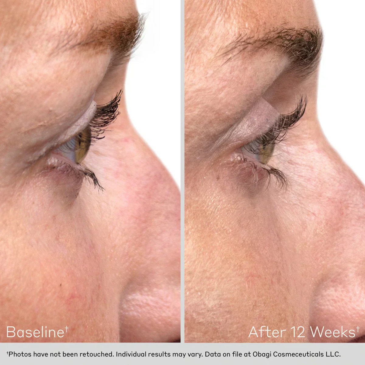 Eyelash Enhancing Serum