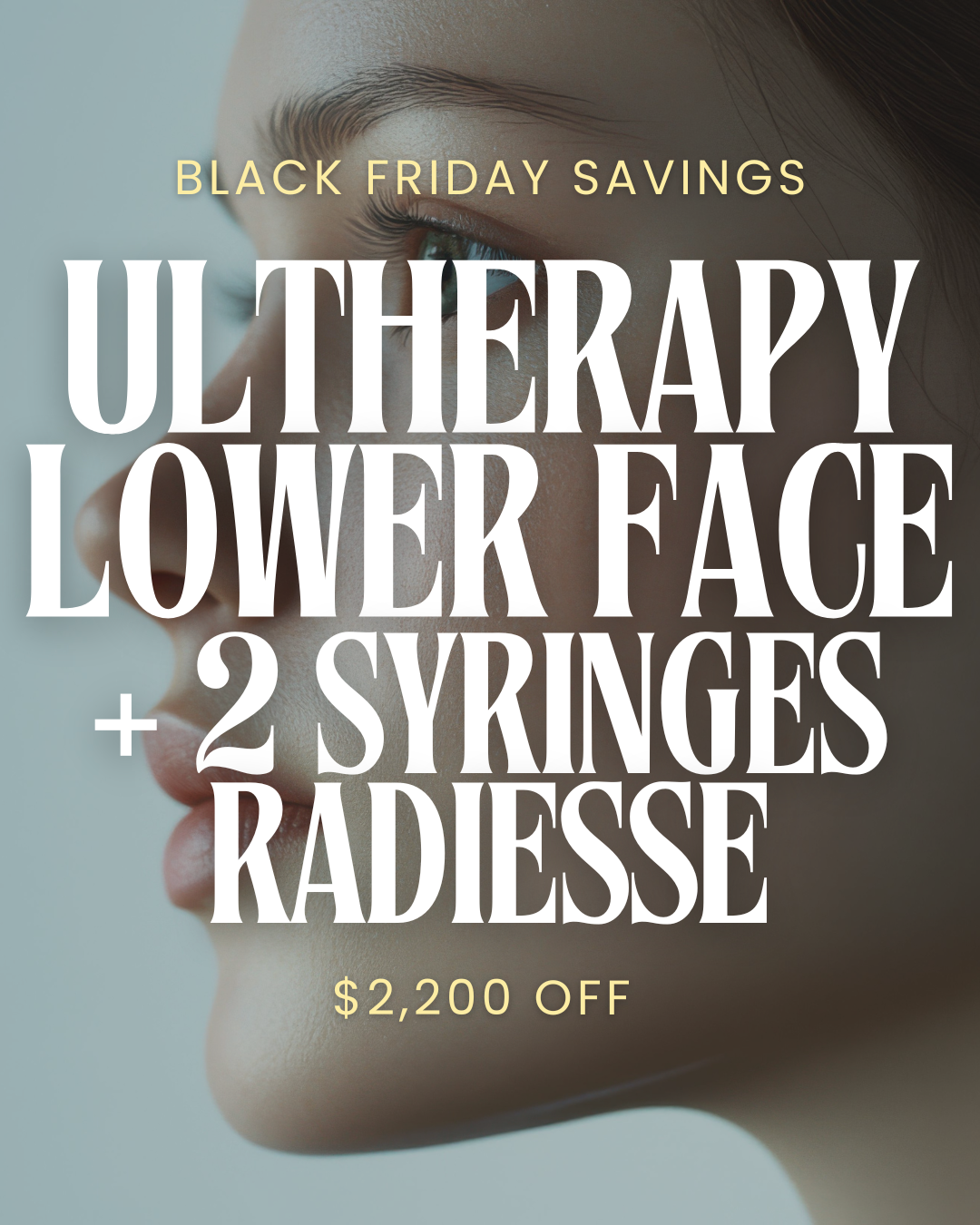 Black Friday Exclusive: Ultherapy Lower Face + 2 Syringes Radiesse