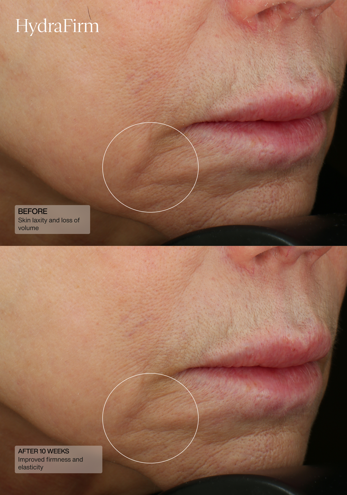 Hydrafirm (Dermal Contour Pressed Serum)