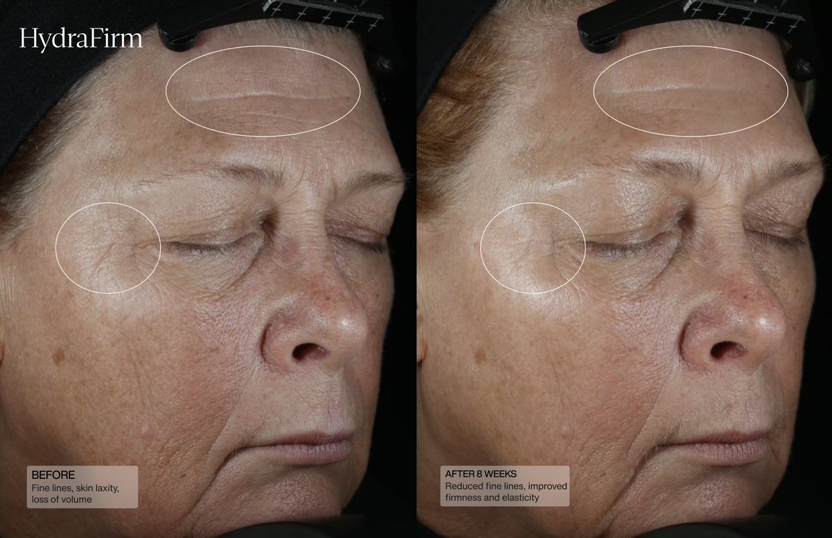 Hydrafirm (Dermal Contour Pressed Serum)