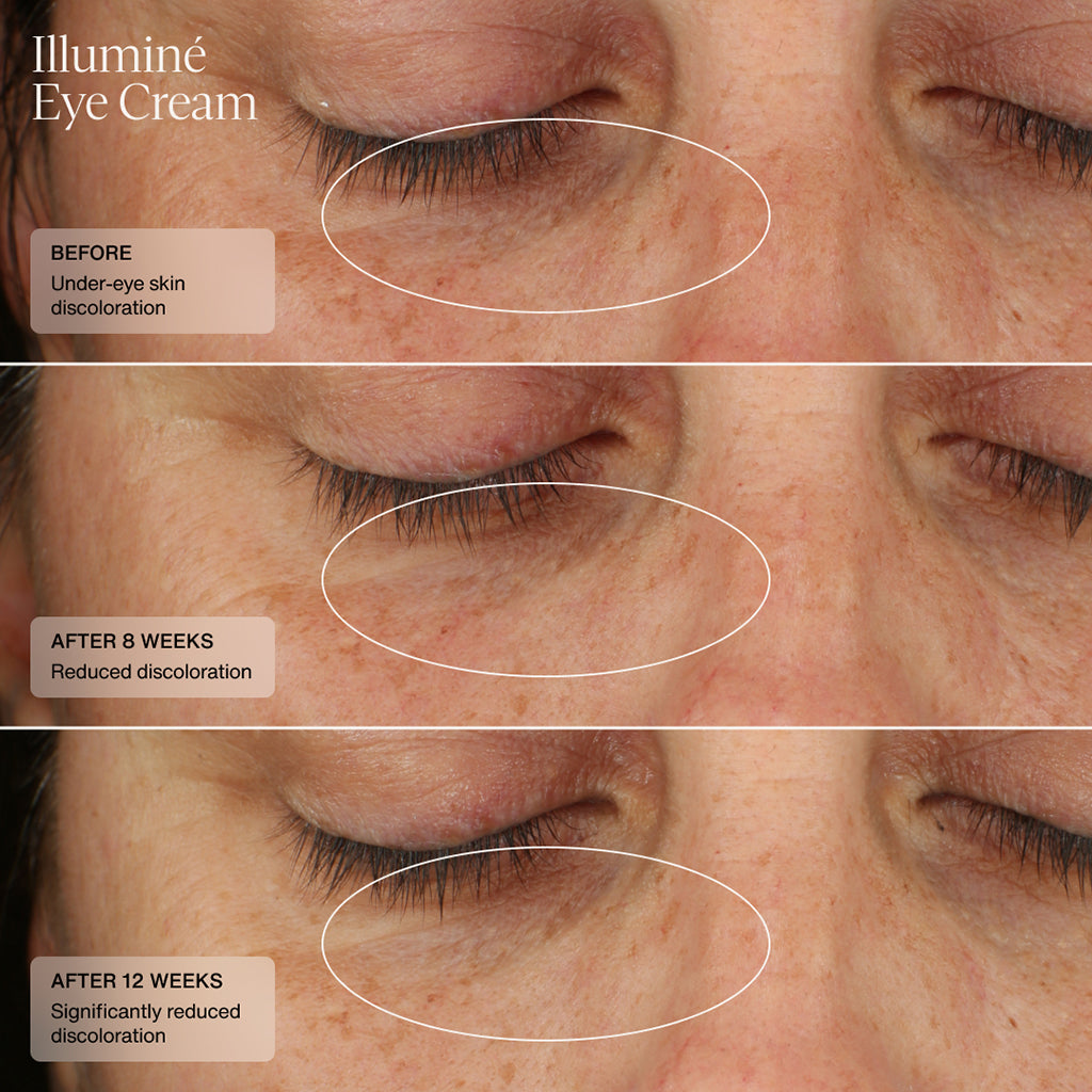 Illumin Eye Cream